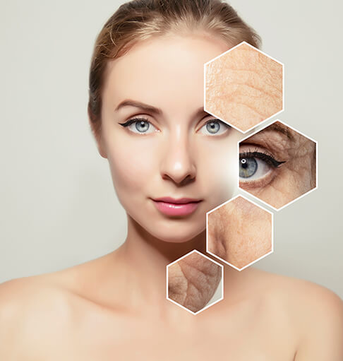 Image skincare kozmetika kezelés kecskemét