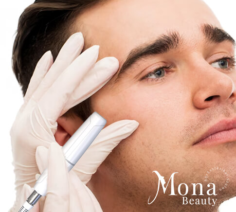 kozmetikai kezelés férfiaknak, kecskemét, szépségszalon, Microson Pen HIFU kezelés, arc-lifting, állvonal emelése, feszesítő, ráncok csökkentése